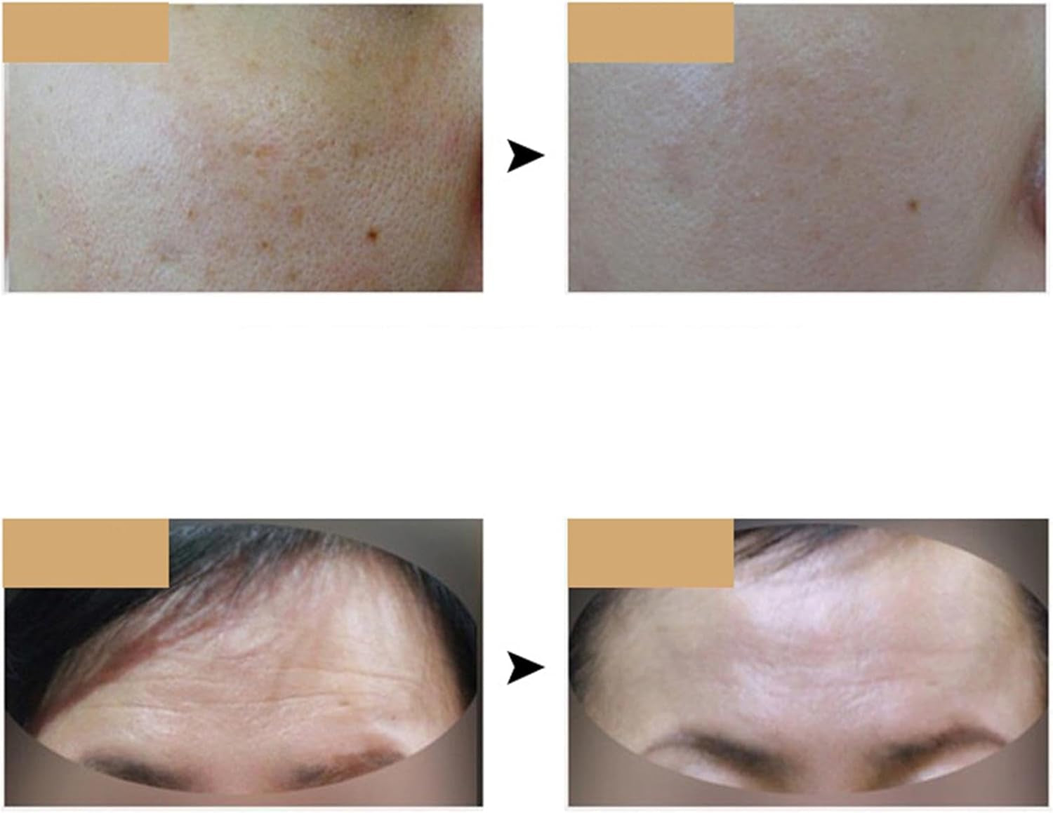 Masque LED Pour Le Visage,Soins De La Peau Avec Masque LED - Masque De Soin De La Peau Du Visage À Lumière LED 7 Couleurs - Masque De Beauté LED Rechargeable Pour Usage Domestique, Out De